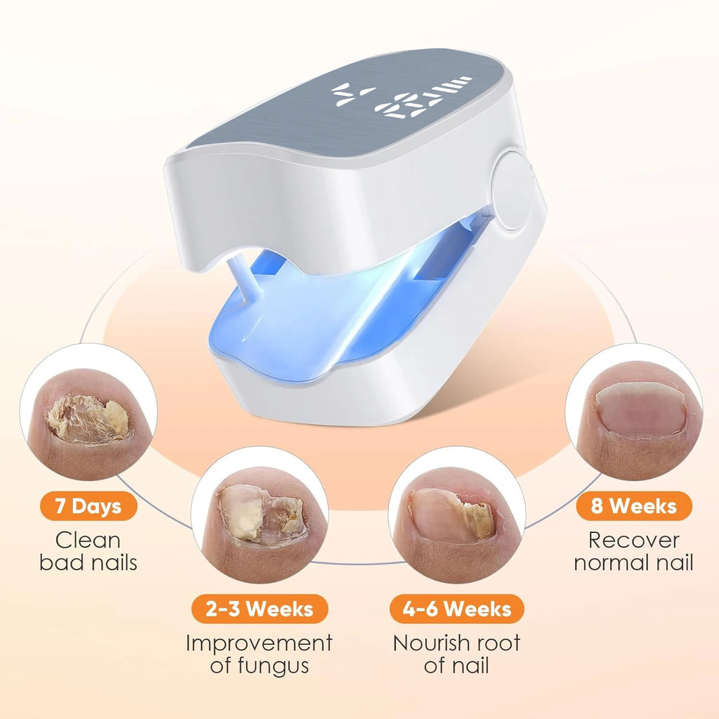 Nail Fungus Laser Device